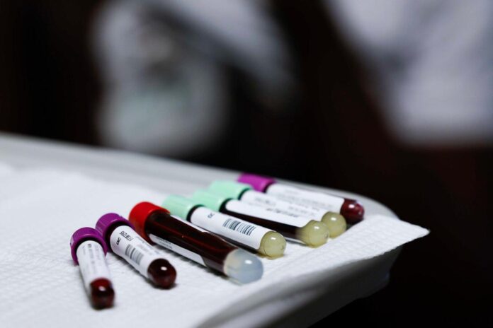 Dallas scientist wins award from American Heart Association for genetic discovery