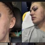 Springfield Woman Speaks Out After Ex-Boyfriend’s Brutal Attack — And 19 Alleged Violations of Her Protection Order