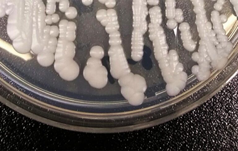 CT experts warn about a new ‘superbug’ fungus resistant to treatment
