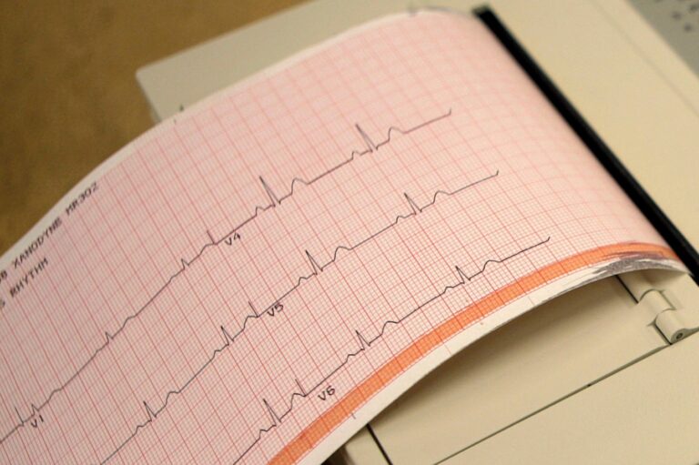 What is atrial fibrillation and how is it treated?