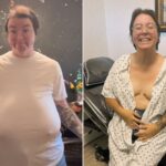 Living With G-Cup Breasts After Baby — and the Surgery That Changed Everything